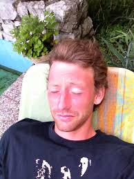 Последние твиты от kimberly mecir (@mecirkimberly). Miloslav Mecir Jr On Twitter Forgot To Put Suncreem On And Spend Just A Little To Much Time On Tenis Court Http T Co Du0lixbe