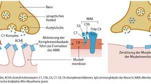 The usual cause is an acquired immunological abnormality the prevalence of myasthenia gravis in the united states is estimated at 14 to 20 per 100,000 population, approximately 36,000 to 60,000 cases. Welche Bedeutung Hat Das Komplementsystem Springermedizin De