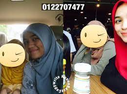 Bawang hitam membantu mencegah penyakit stroke dan serangan jantung. Nurul Husna Muka Putih Tangan Hitam