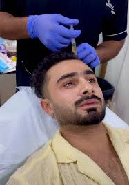 PRP strong your hair🫰🏾#alexsafi #foryou #foryoupage #peshawar @alex ...