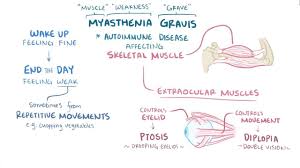 Patients suffered from bronchopulmonary infection with myasthenia gravis as a background were included in this study. Myasthenia Gravis Osmosis