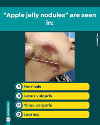 Image result for Diascopy