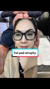 Understanding Fat Pad Atrophy: Causes and Treatment Options
