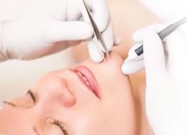 Please consult your electrologist before selecting a course. Electrolysis Hair Removal Course In Ipswich Jinc Beauty