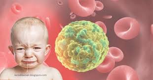 Saksikan episod terakhir ini untuk mengetahui perjuangan alif dalam jangka masa panjang. Penyembuh Kanser Terdapat 3 Jenis Kanser Darah Yang Biasa Berlaku Iaitu Leukemia Lymphoma Dan Myeloma 1 Kanser Darah Leukemia Leukemia Adalah Kanser Yang Berlaku Dalam Darah Dan Sum Sum Tulang