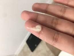 The ability to maintain that pregnancy is another story, but the whole process of going into heat is telegraphing the egg is ready and in position. Tmi Is It Ovulation Discharge Or Does It Look Like Pregnancy Discharge Trying For A Baby Babycenter Canada