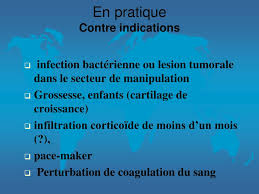 Irritations, ecchymoses, douleurs locales temporaires. Ppt Traitement Par Ondes De Choc Extracorporelles Powerpoint Presentation Id 859435