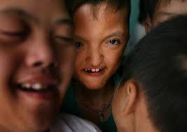 Samples, provision of quality assurance. Dava The Da Nang Association For Victims Of Agent Orange Dioxin Home Facebook
