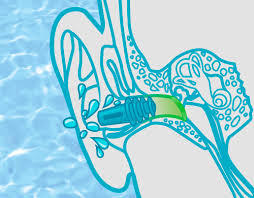 Sanohra Swim Wasserdichte Ohrstopsel Zum Schwimmen Online Bei Sanohra Com