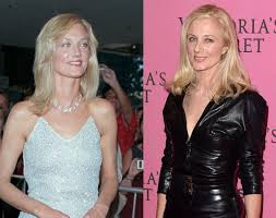 31.12.2012 · dyan cannon plastic surgery has been an interesting topic in hollywood over the years. 5 Celebrities Who Look Better As They Age Newbeauty