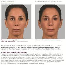 My body looks good with clothes i don't look flat flat like i do without clothes. Sculptra Srs Dermatology Suzanne Sirota Rozenberg Do Faocd