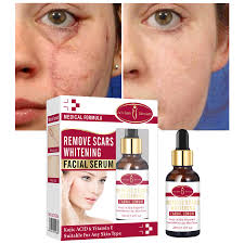 What does lemon juice do to skin? Acne Scar Removal Serum Pimples Stretch Marks Face Gel Remove Acne Smoothing Whitening Moisturizing Body Essence Skin Care 30ml Serum Aliexpress