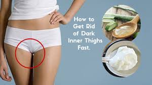 What should i do about my inner thighs? How To Get Rid Of Dark Buttocks In A Week Best Beauty Lifestyle Blog