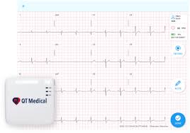 Image result for Electrocardiogram Validity