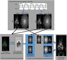 Whole-Heart Non-Rigid Motion Corrected Coronary Mra With Autofocus Virtual  3D Inav - Sciencedirect