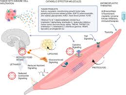 Image result for Cachexia in Cancer