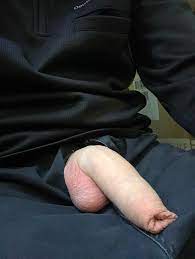 uncut floppy penis : rforeskin