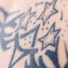 Maybe you would like to learn more about one of these? Laser Tattoo Removal Minimally Invasive Aesthetic Surgery Groupon