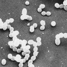 Image result for Streptococcus