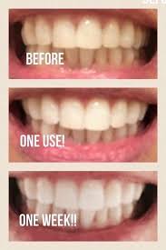 Pin On Whitening Fluoride Toothpaste