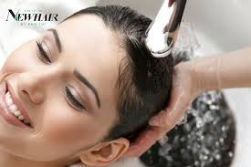 Hiệu quả cấy tóc tự thân có vĩnh viễn không?