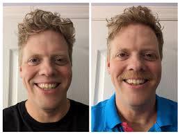 Derek Stoppels (@TheStoppelsShow)