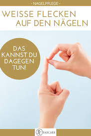Und sehr viele menschen schauen beim kennenlernen als erstes auf die fingernägel. Weisse Flecken Auf Den Fingernageln Ursache Und Losung Fabcare Nagelpflegeselbermachen Nagelpflegehausmittel Nagelpflege Haare Pflegen Haarpflege Tipps