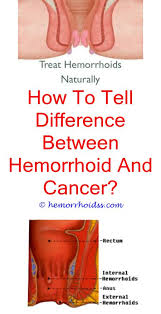Simple instructions on how to treat the problem of diarrhea for dogs. Dog External Hemorrhoid Treatment