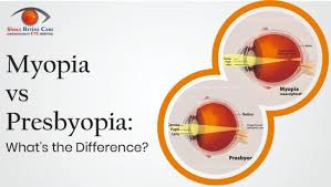 Image result for Presbyopia