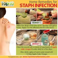 Staph Infection Prevention And Home Remedies Top 10 Home Remedies Holistic Health Remedies Holistic Remedies Natural Health Remedies
