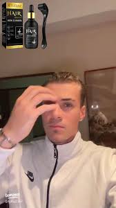 Minoxidil for Hair Growth: Effective Solutions and Tips