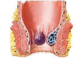 Encima línea dentada plexo hemorroidal interno sistema porta mucosa rectal bajo número: Hemorroides Dr Romulo Calvo Especialista En Proctologia Y Piso Pelvico
