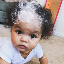 As noted in baby center, it's normal for your baby to lose hair during the first months of life, thanks to a drop in hormone levels. This Baby Was Born With The Same White Hair Streak As Her Mom Allure