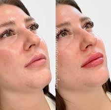 Cydney Brown BSN, RN (@cosmeticnursecydney) • Instagram photos and videos