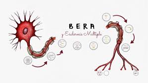 In multiple sclerosis, the protective coating on nerve fibers (myelin) is damaged and may eventually be destroyed. Bera Y Esclerosis Multiple By Maria Pinto On Prezi Next