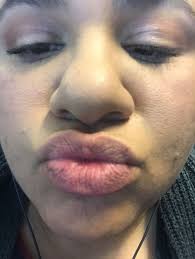 Peppermint stick scent for winter freshness