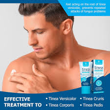 Amazon.com: טיפול Roycederm Tinea Versicolor, טיפול בכף הרגל לספורטאים,  טיפול גזזת לבני אדם, לטינאה ורסיקולור ופדיס, קרם עור אנטי פטרייתי ריפוי  מהיר