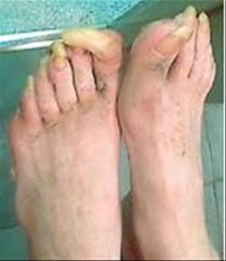 Está muy bien tener unas manos cuidadas, con uñas largas pintadas con los colores de la. Unas Pies Largas Un Dibujo Bonito