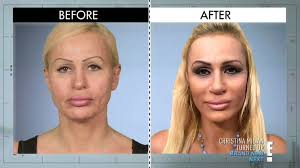 Megasilikóny jej nestačili, upravili ju aj tam dole. Tu už ale plastiky  nepomôžu!