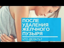 диета 5 меню на неделю рецепты после удаления желчного пузыря Esli Udalen Zhelchnyj Puzyr Vazhno Znat Youtube Puzyri Zdorove Naturalnye Sredstva