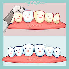 Kono subarashii sekai ni shukufuku o 2019 elenco. 9 Best Laser Teeth Whitening In Petaling Jaya Price Guide Reviews
