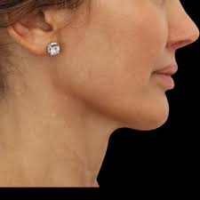 Nima Naghshineh, MD, FACS