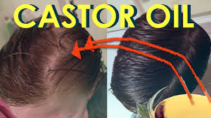 Does castor oil help with hair loss? Castor Oil For Hair Growth Before And After Photos Stop Hair Loss With Castor Oil Grow Sexy Hair Youtube