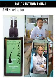 Neo hair lotion how to use. Dr Qudus Action International Neo Hair Lotion Hair Facebook