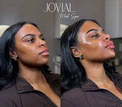 Jovialmedspa (@jovialmedspa) · Philadelphia, PA