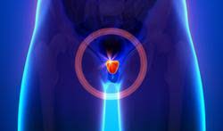 Il n en fut rien. Incontinence Chez L Homme Causes Symptomes Traitements Passionsante Be