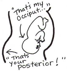 Image result for Manual Rotation in Occipitoposterior Presentation