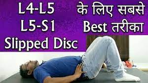 Slip disc exercise hindi mai. L4 L5 L5 S1 Slipped Disc Treatment Best Exercise To Cure Slipped Disc Disc Bulging Or Herniation