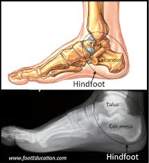 The talus bone supports the leg bones (tibia and fibula), forming the ankle. Hindfoot Fractures Orthopaedia