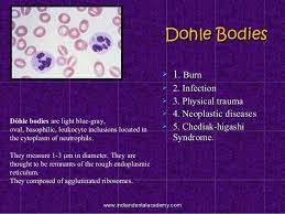 Table of contents what causes dohle bodies? Pin On Opath